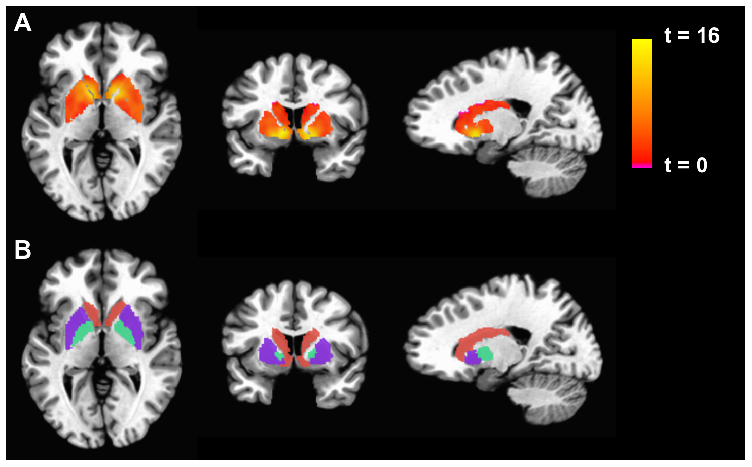 Il cervello che legge alla luce del bioimaging